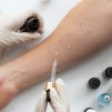 How is dermatological testing done?